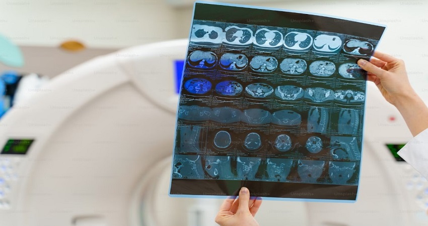 Best Hospital In Chhattisgarh For Neurosurgery.jpg