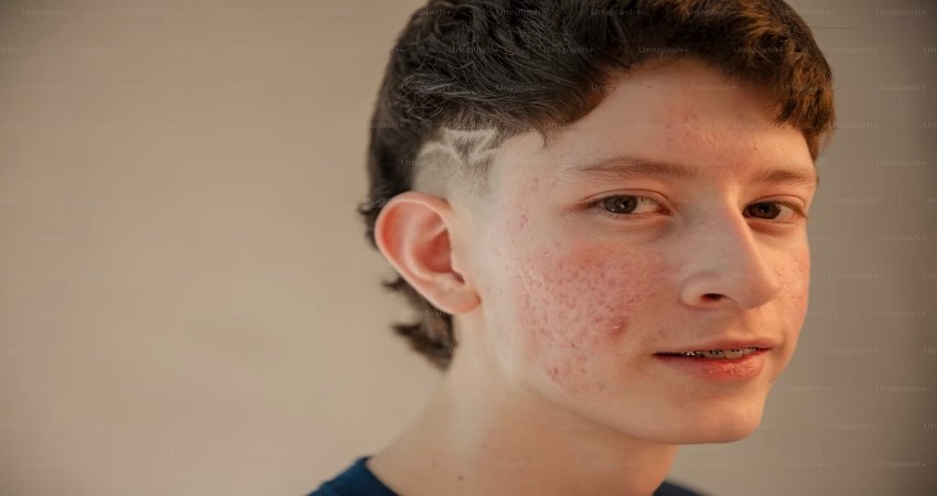 Best Hospitals In Gujarat For Skin Problems.jpg