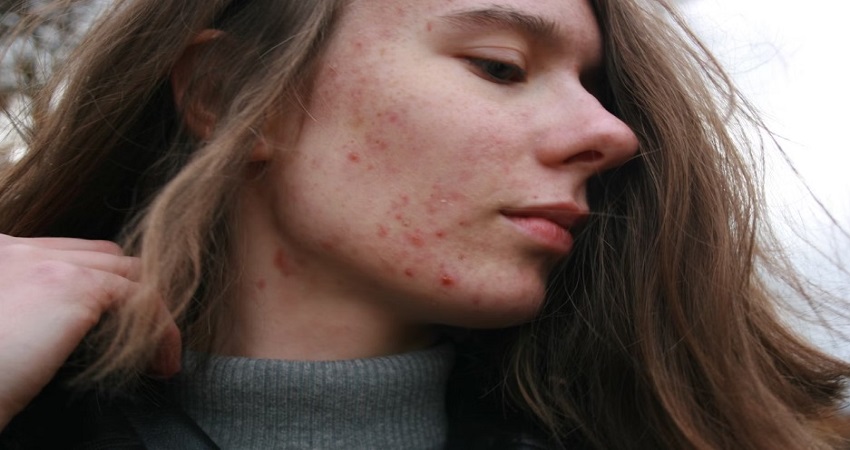 Best Hospitals In Haryana For Skin Problems.jpg