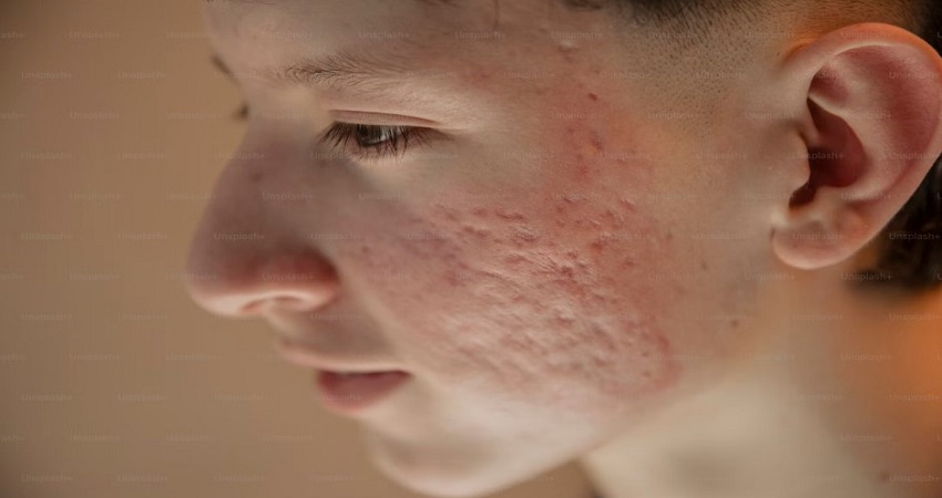 Best Hospitals In Kolkata For Skin Problems.jpg